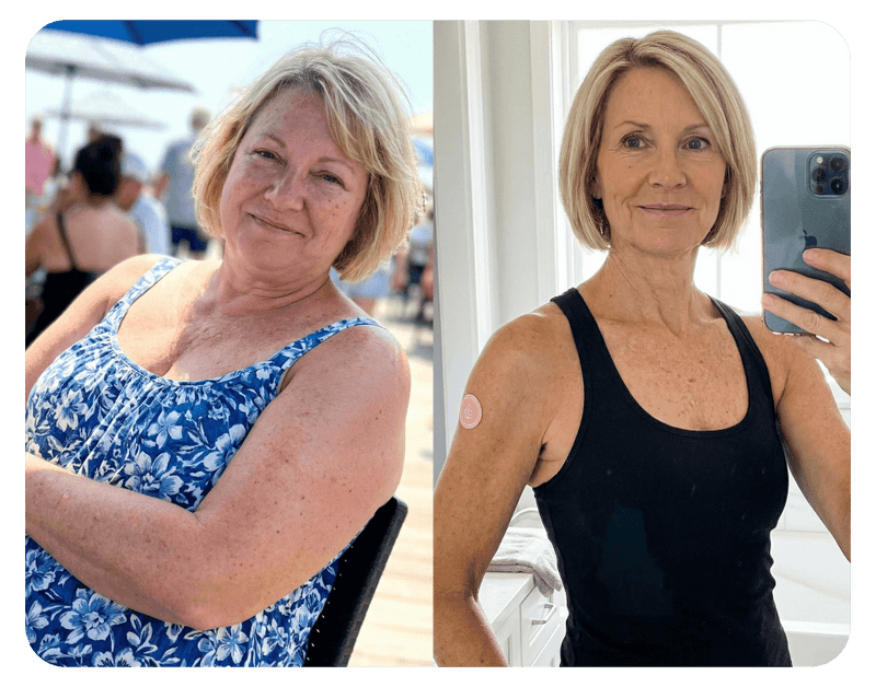 Before and After Result 2