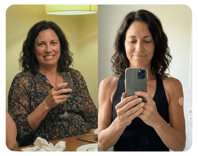 Before and After Result 3